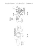 Methods and systems for making a blood vessel sleeve diagram and image