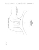 Methods and systems for making a blood vessel sleeve diagram and image
