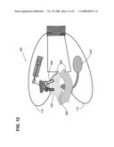 Sensing surgical fastener diagram and image