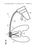 Sensing surgical fastener diagram and image
