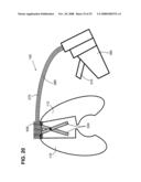 Surgical fastening device with cutter diagram and image