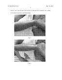 Chitosan gel for dermatological use, production method therefor and use of same diagram and image