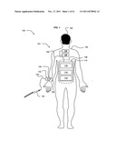 Wearable power source carryable by a health care provider diagram and image