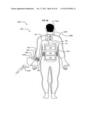 Wearable power source carryable by a health care provider diagram and image