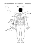 Wearable wireless power transmitter diagram and image