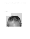 HAIR GROWTH AND FOSTERING AGENT diagram and image