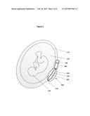 Method for Administering a Medicament to a Fetus diagram and image