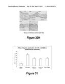 Molecular and Herbal Combinations for Treating Psoriasis diagram and image