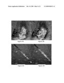Multi-Plane/Multi-Slice Processing For 2-D Flow Imaging in Medical Diagnostic Ultrasound diagram and image