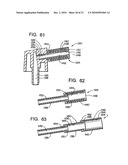 Actuator Systems and Methods for Aerosol Wall Texturing diagram and image