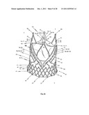 Prosthetic Heart Valve And Transcatheter Delivered Endoprosthesis     Comprising A Prosthetic Heart Valve And A Stent diagram and image