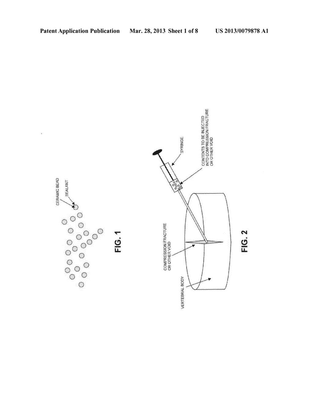 METHOD AND APPARATUS FOR TREATING COMPRESSION FRACTURES IN VERTEBRAL     BODIES - diagram, schematic, and image 02