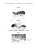 METHODS FOR PREPARATION OF NEO-CARTILAGE CONSTRUCTS diagram and image