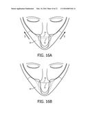 METHOD AND DEVICE FOR SIZING MASKS diagram and image