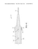 BALLOON CATHETER HAVING A RETRACTABLE SHEATH AND LOCKING MECHANISM WITH     BALLOON RECAPTURE ELEMENT diagram and image
